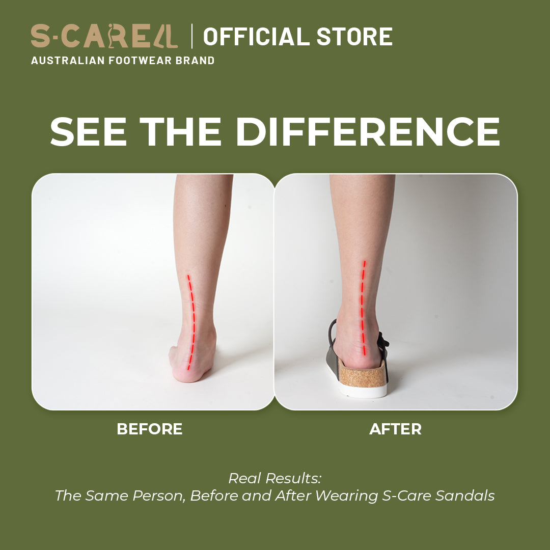 Olympia Performance Insoles